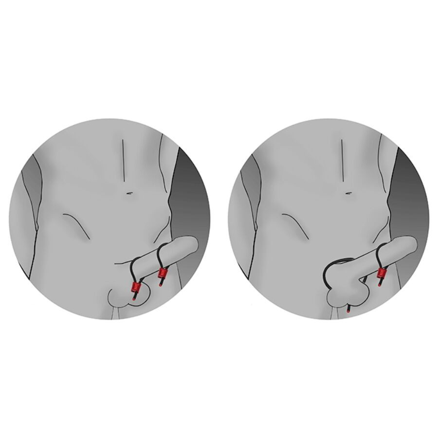 ELECTRASTIM - PRESTIGE ELECTRA LOOPS ADJUSTABLE COCK RINGS BLACK - Image 2