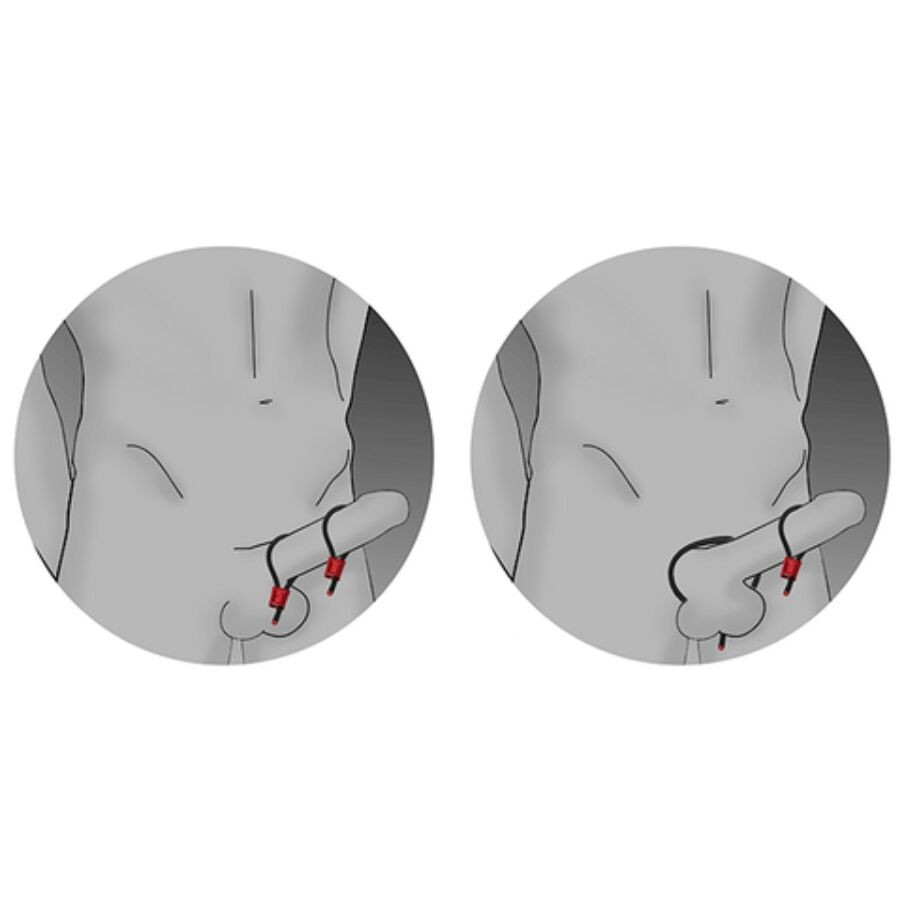 ELECTRASTIM - PRESTIGE ELECTRA LOOPS ADJUSTABLE COCK RINGS RED - Image 3